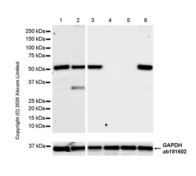 Western blot - Anti-Lipoprotein lipase antibody [EPR31098-680] (AB328031)