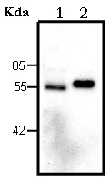 Western blot - Anti-Lipoprotein lipase antibody [LPL.A4] (AB21356)