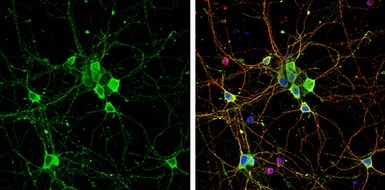 Immunocytochemistry/ Immunofluorescence - Anti-Liprin alpha 2 antibody (AB155411)