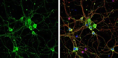 Immunocytochemistry/ Immunofluorescence - Anti-Liprin alpha 2 antibody (AB155411)