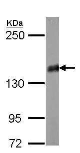 Western blot - Anti-Liprin alpha 2 antibody (AB155411)