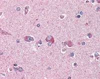 Immunohistochemistry (Formalin/PFA-fixed paraffin-embedded sections) - Anti-LIS1 antibody (AB117457)
