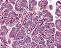 Immunohistochemistry (Formalin/PFA-fixed paraffin-embedded sections) - Anti-LIS1 antibody (AB117457)