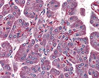 Immunohistochemistry (Formalin/PFA-fixed paraffin-embedded sections) - Anti-LIS1 antibody (AB117457)