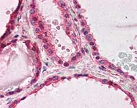 Immunohistochemistry (Formalin/PFA-fixed paraffin-embedded sections) - Anti-LIS1 antibody (AB117457)
