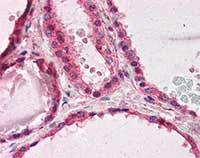 Immunohistochemistry (Formalin/PFA-fixed paraffin-embedded sections) - Anti-LIS1 antibody (AB117457)