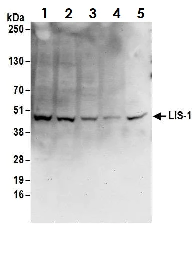 Western blot - Anti-LIS1 antibody (AB2607)