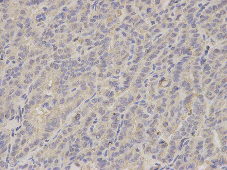 Immunohistochemistry (Formalin/PFA-fixed paraffin-embedded sections) - Anti-LITAF antibody (AB187533)