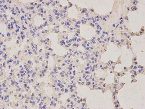 Immunohistochemistry (Formalin/PFA-fixed paraffin-embedded sections) - Anti-LITAF antibody (AB187533)