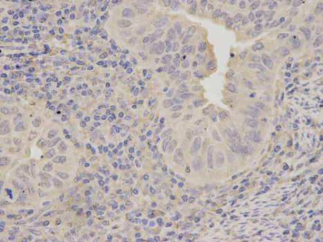 Immunohistochemistry (Formalin/PFA-fixed paraffin-embedded sections) - Anti-LITAF antibody (AB187533)