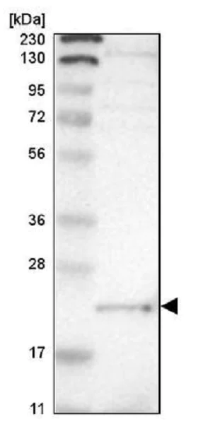 Western blot - Anti-LITAF antibody (AB224066)
