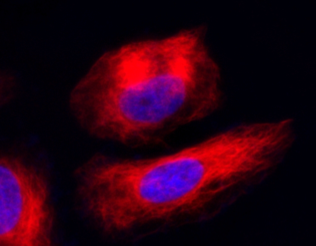 Functional Studies - Live Cell Tubulin Staining Kit (Fluorimetric) (AB324125), expandable thumbnail