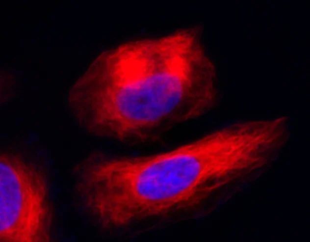 Functional Studies - Live Cell Tubulin Staining Kit (Fluorimetric) (AB324125)