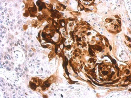 Immunohistochemistry (Formalin/PFA-fixed paraffin-embedded sections) - Anti-Liver Arginase antibody (AB272887)