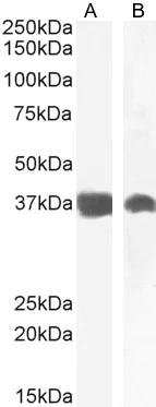 Western blot - Anti-liver Arginase antibody (AB60176)