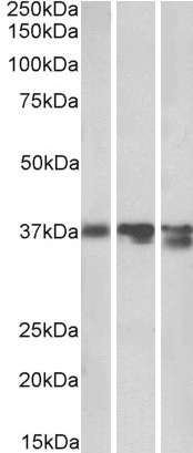 Western blot - Anti-Liver Arginase antibody (AB92274), expandable thumbnail