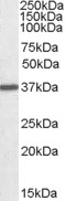Western blot - Anti-Liver Arginase antibody (AB92274), expandable thumbnail