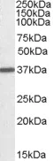 Western blot - Anti-Liver Arginase antibody (AB92274)