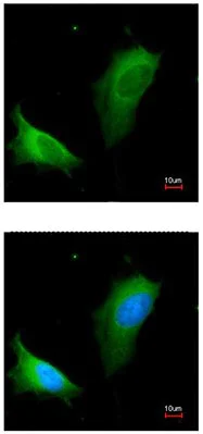 Immunocytochemistry/ Immunofluorescence - Anti-Liver Arginase antibody (AB96183)