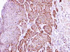 Immunohistochemistry (Formalin/PFA-fixed paraffin-embedded sections) - Anti-Liver Arginase antibody (AB96183)
