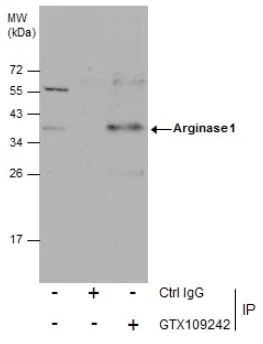 Immunoprecipitation - Anti-Liver Arginase antibody (AB96183)