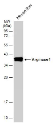 Western blot - Anti-Liver Arginase antibody (AB96183)