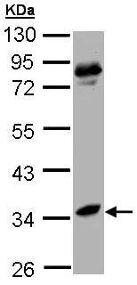 Western blot - Anti-Liver Arginase antibody (AB96183)