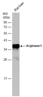 Western blot - Anti-Liver Arginase antibody (AB96183)