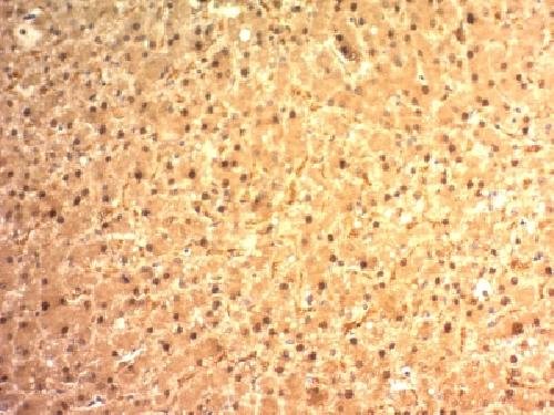 Immunohistochemistry (Formalin/PFA-fixed paraffin-embedded sections) - Anti-Liver Arginase antibody [ARG1/1125] (AB215843), expandable thumbnail