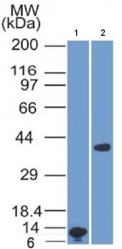 Western blot - Anti-Liver Arginase antibody [ARG1/1125] (AB215843), expandable thumbnail