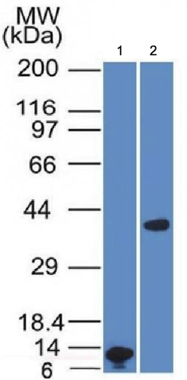 Western blot - Anti-Liver Arginase antibody [ARG1/1125] - BSA and Azide free (AB212522), expandable thumbnail