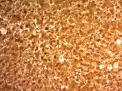 Immunohistochemistry (Formalin/PFA-fixed paraffin-embedded sections) - Anti-Liver Arginase antibody [ARG1/1126] (AB215894)