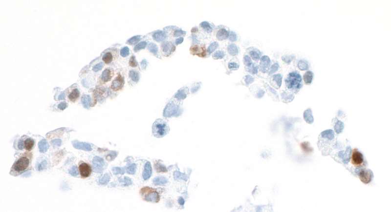 Immunocytochemistry - Anti-Liver Arginase antibody [BLR036F] (AB243892), expandable thumbnail