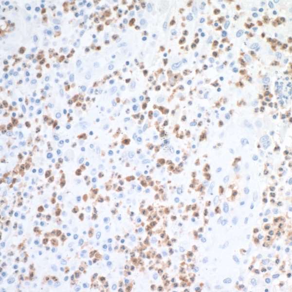 Immunohistochemistry (Formalin/PFA-fixed paraffin-embedded sections) - Anti-Liver Arginase antibody [BLR036F] (AB243892), expandable thumbnail