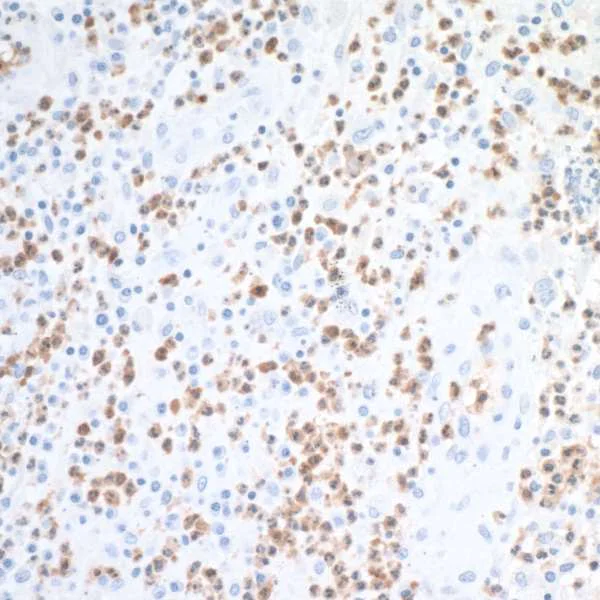 Immunohistochemistry (Formalin/PFA-fixed paraffin-embedded sections) - Anti-Liver Arginase antibody [BLR036F] (AB243892)