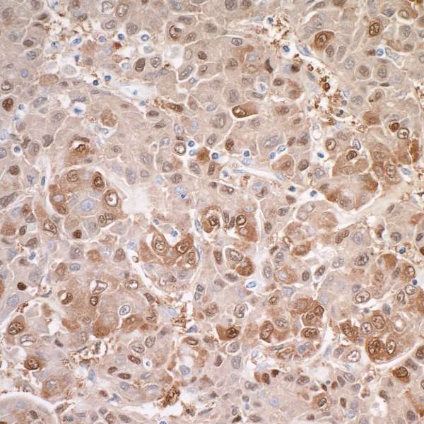 Immunohistochemistry (Formalin/PFA-fixed paraffin-embedded sections) - Anti-Liver Arginase antibody [BLR036F] (AB243892), expandable thumbnail