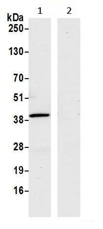 Immunoprecipitation - Anti-Liver Arginase antibody [BLR036F] (AB243892), expandable thumbnail