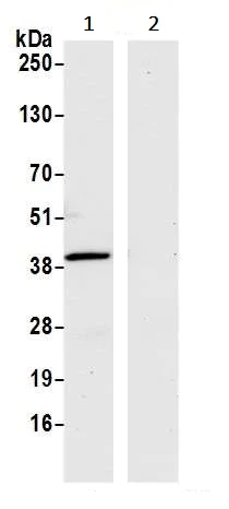 Immunoprecipitation - Anti-Liver Arginase antibody [BLR036F] (AB243892)