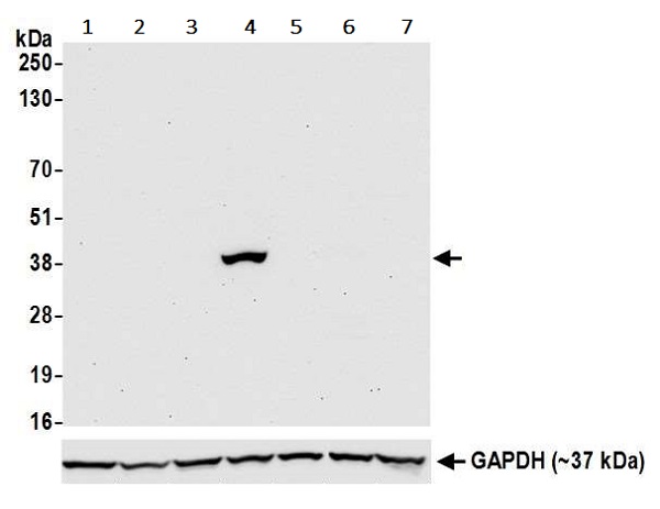 Western blot - Anti-Liver Arginase antibody [BLR036F] (AB243892), expandable thumbnail