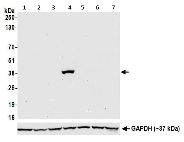 Western blot - Anti-Liver Arginase antibody [BLR036F] (AB243892)