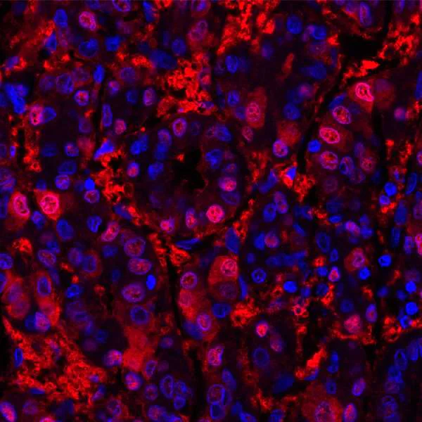 Immunohistochemistry (Formalin/PFA-fixed paraffin-embedded sections) - Anti-Liver Arginase antibody [BLR036F] - BSA free (AB272083)