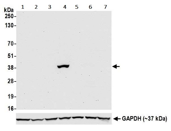 Western blot - Anti-Liver Arginase antibody [BLR036F] - BSA free (AB272083), expandable thumbnail