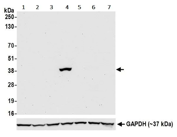 Western blot - Anti-Liver Arginase antibody [BLR036F] - BSA free (AB272083)