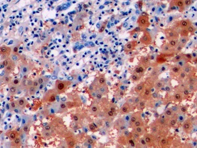 Immunohistochemistry (Formalin/PFA-fixed paraffin-embedded sections) - Anti-Liver Arginase antibody [C5] (AB239731)