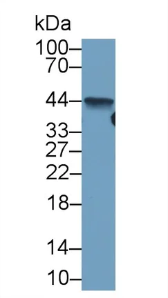 Western blot - Anti-Liver Arginase antibody [C5] (AB239731)