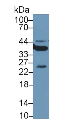 Western blot - Anti-Liver Arginase antibody [C5] (AB239731)