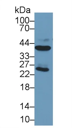 Western blot - Anti-Liver Arginase antibody [C5] (AB239731)