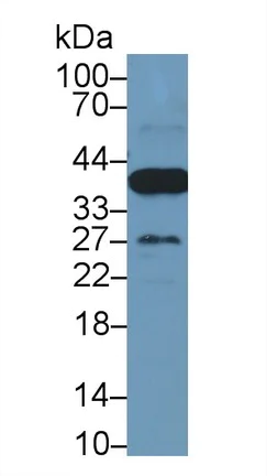 Western blot - Anti-Liver Arginase antibody [C5] (AB239731)