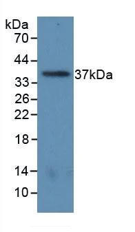 Western blot - Anti-Liver Arginase antibody [C5] (AB239731)