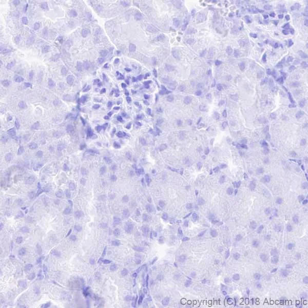 Immunohistochemistry (Formalin/PFA-fixed paraffin-embedded sections) - Anti-Liver Arginase antibody [EPR19652] (AB203490)